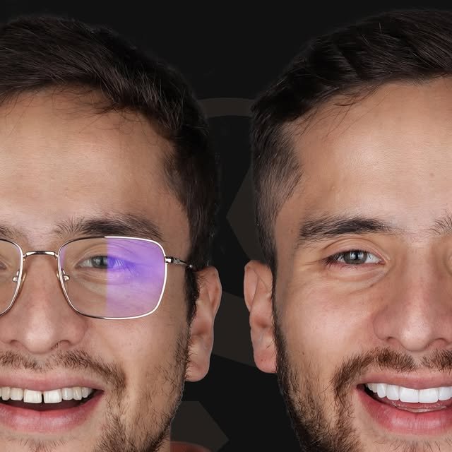 Antes y después de rehabilitación