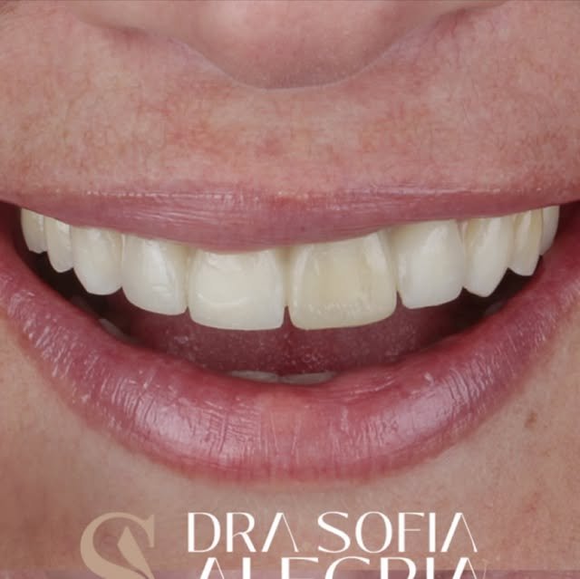 Sonrisa terminada