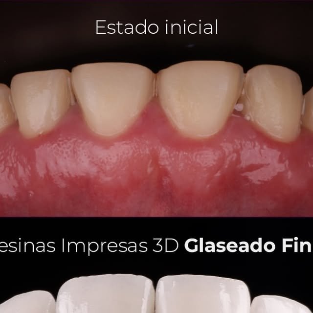Resinas impresas en 3D antes y después