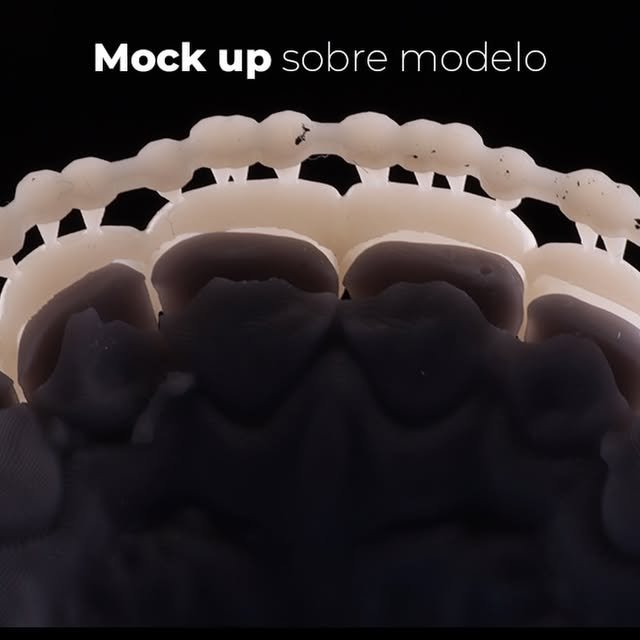 Mock up de rehabilitación impreso en 3D sobre modelo