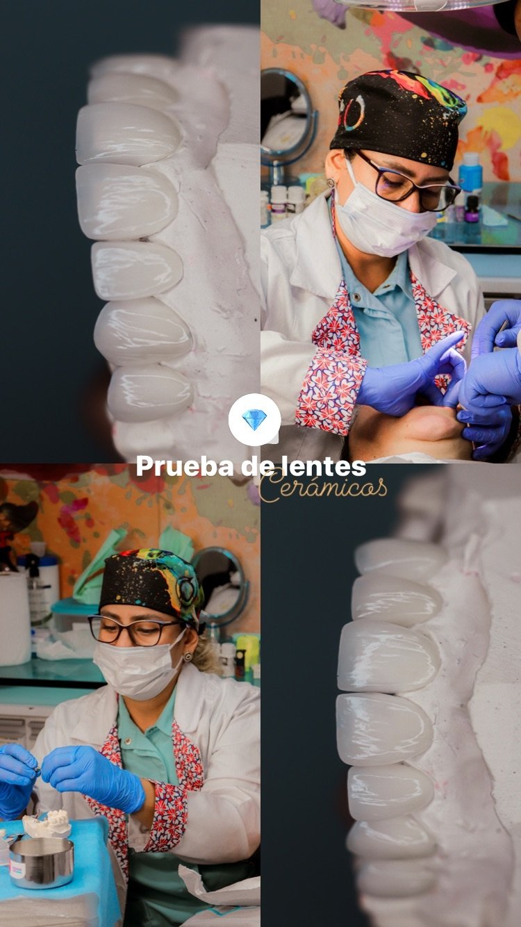 Prueba de lentes cerámicos con el equipo